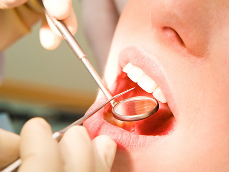 ③口腔内の検査・歯周病検査